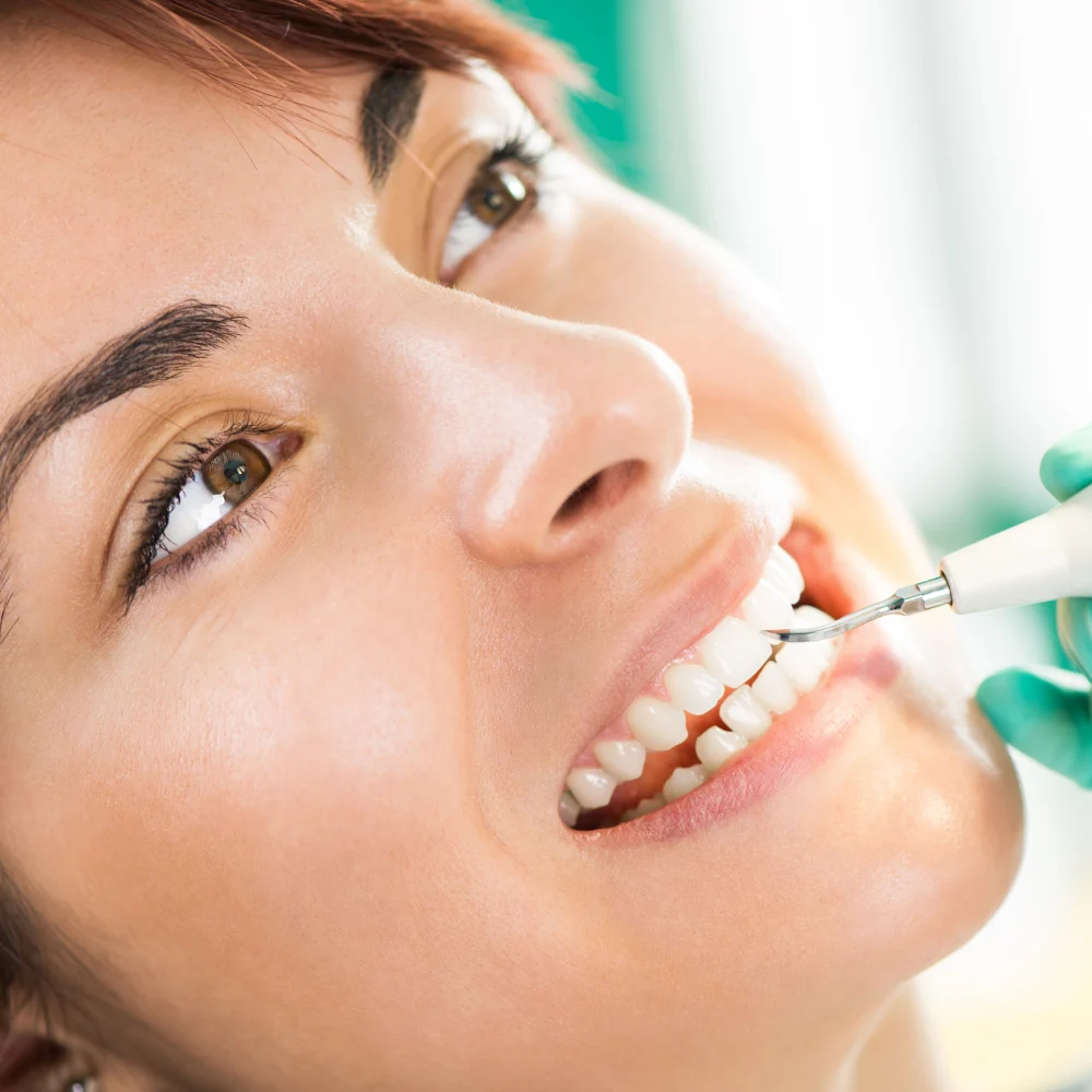 dental clean