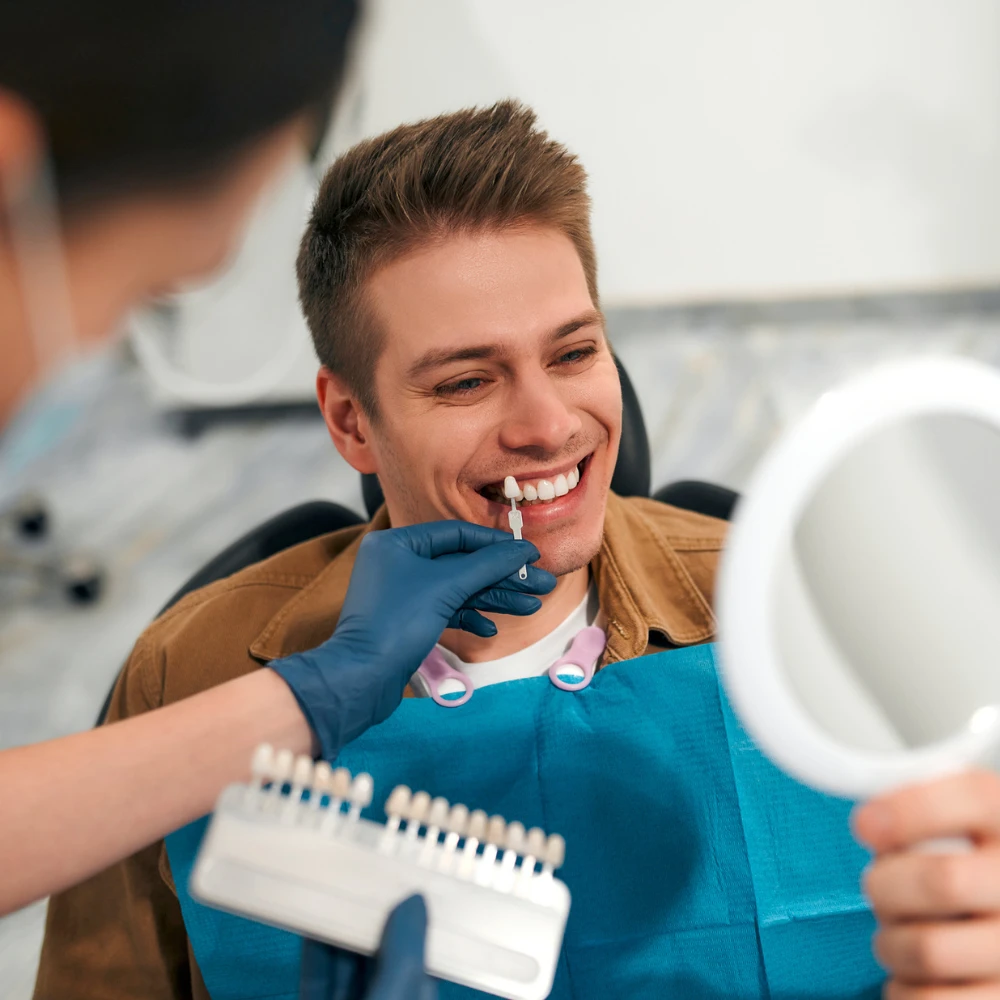 veneers 1